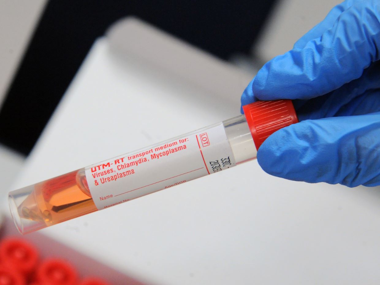 Covid-19: i dati di giovedì 31 dicembre 2020