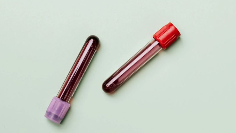 Nel sangue ci sono “molecole-spia” dell’invecchiamento