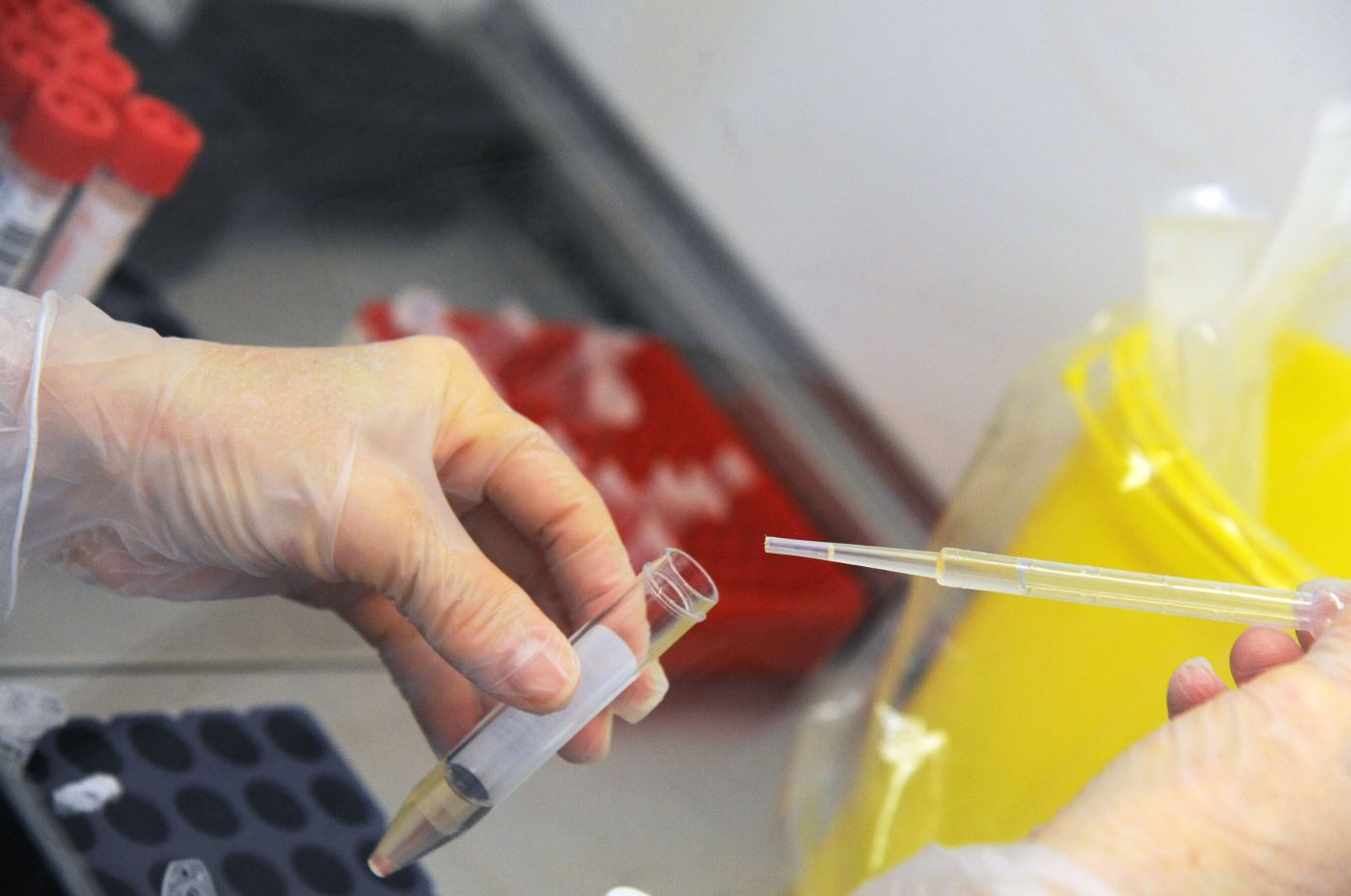 Covid-19, in Veneto parte la sperimentazione sui test fai-da-te