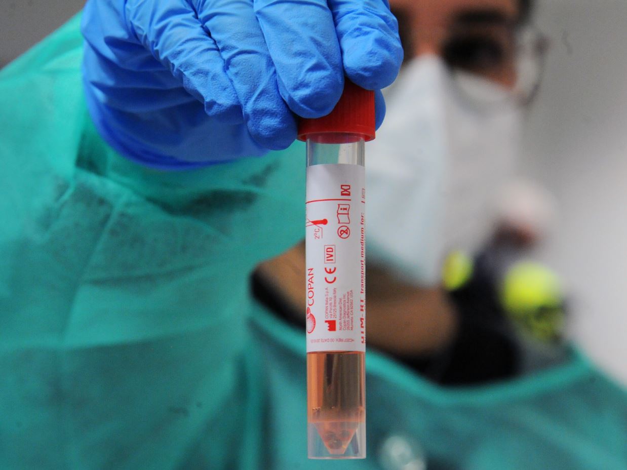 Covid-19: i dati di mercoledì 30 dicembre 2020